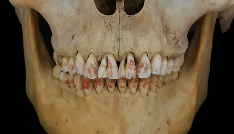 cinnabar-stained-teeth-l
