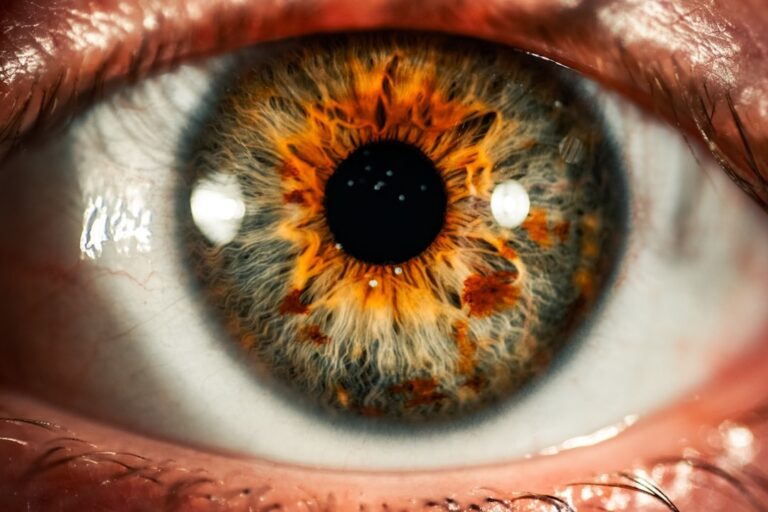 öga iris