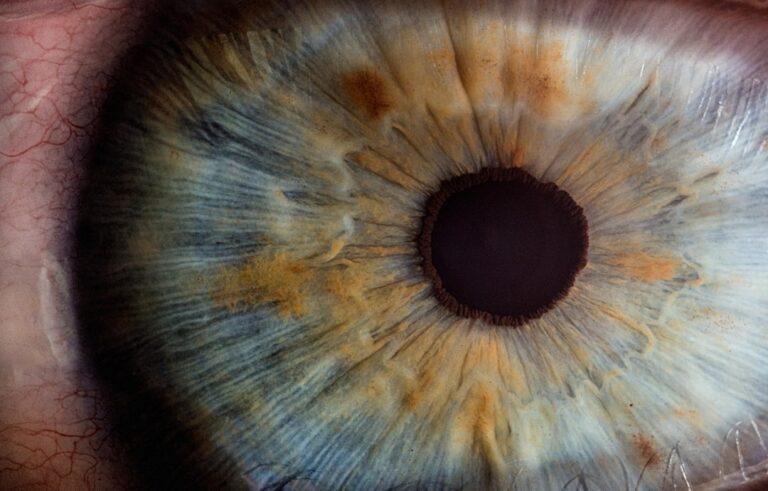 öga iris